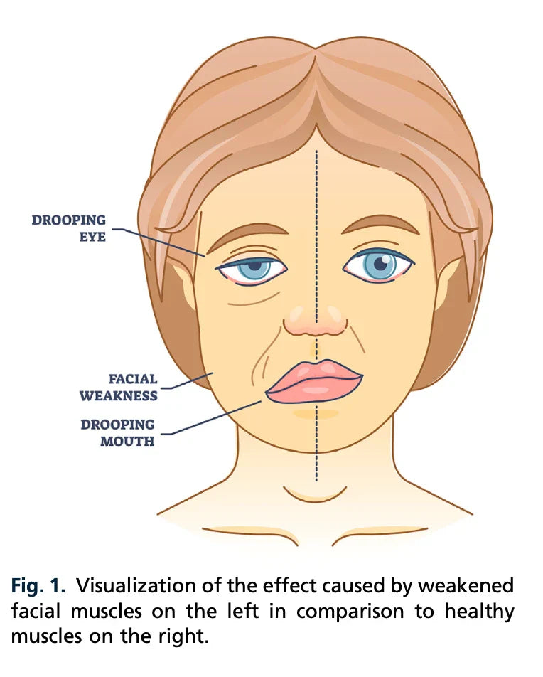 EMS + RF Technology in Medifacial Treatments