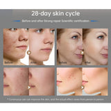 MesoporeMD