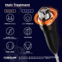 Meso Microneedling RF-V