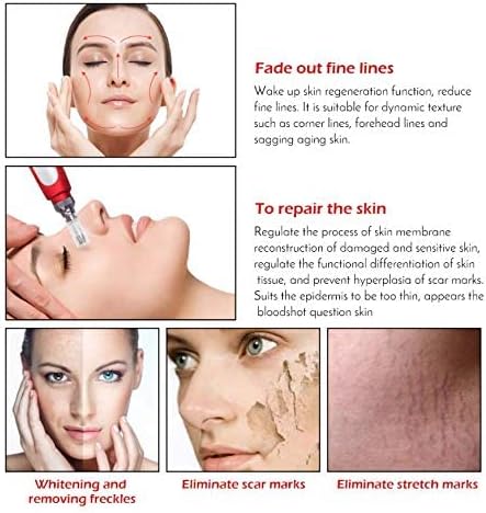 Meso My m Pen Micro Needle Derma Pen for Acne Scars Removal
